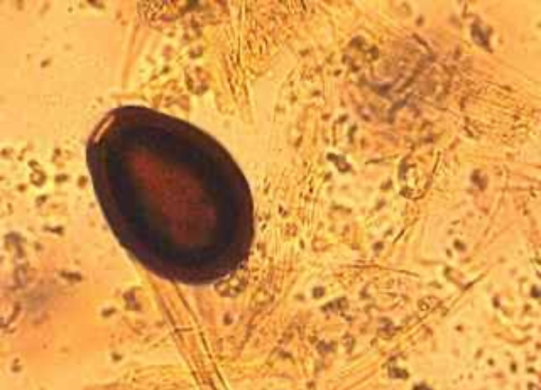 Alpaca Emac - A Lethal Parasite